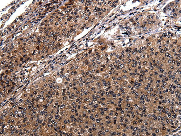 RAB41 Polyclonal Antibody (E-AB-12239)