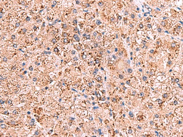 OSBPL2 Polyclonal Antibody (E-AB-52973)