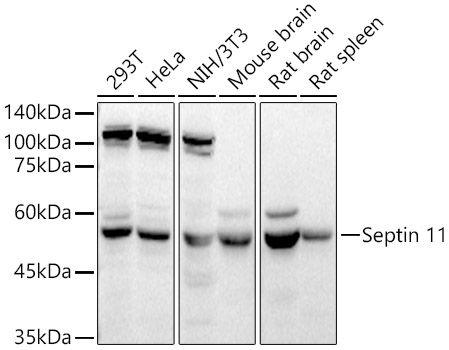 Septin 11 Polyclonal Antibody (E-AB-90367)
