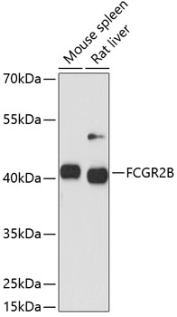 FCGR2B Polyclonal Antibody (E-AB-90425)