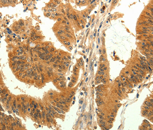 TRPM7 Polyclonal Antibody (E-AB-12916)