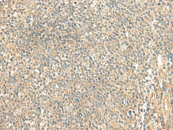 LMO3 Polyclonal Antibody (E-AB-18896)