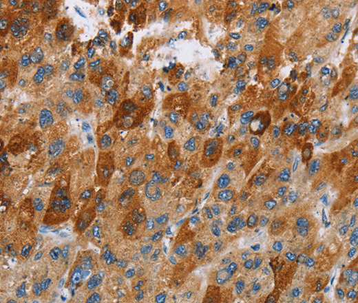 CCR9 Polyclonal Antibody (E-AB-14832)