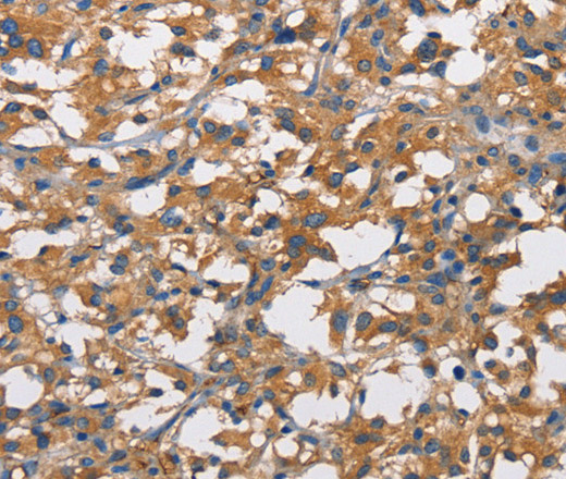 CD73 Polyclonal Antibody (E-AB-14725)