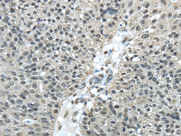 FUS Polyclonal Antibody (E-AB-17101)