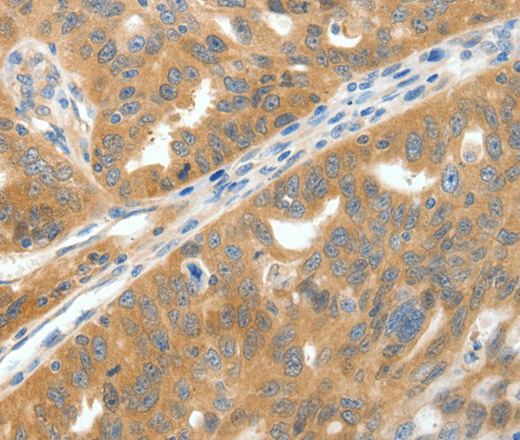 SCN9A Polyclonal Antibody (E-AB-12861)
