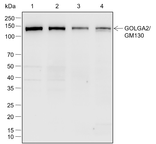 Recombinant GOLGA2/GM130 Monoclonal Antibody (AN302050L)
