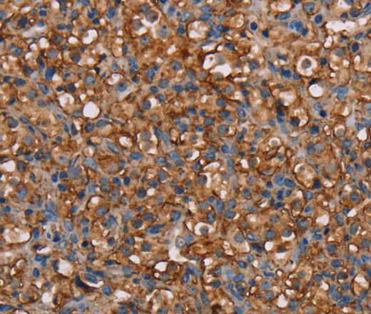 NEDD4L Polyclonal Antibody (E-AB-11440)