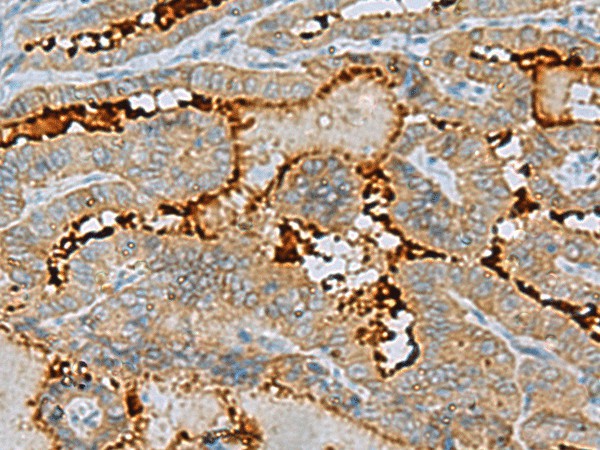 ENKD1 Polyclonal Antibody (E-AB-53159)