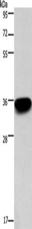 PRPS1/2/PRPS1L1 Polyclonal Antibody (E-AB-15944)
