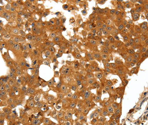SSTR1 Polyclonal Antibody (E-AB-12885)