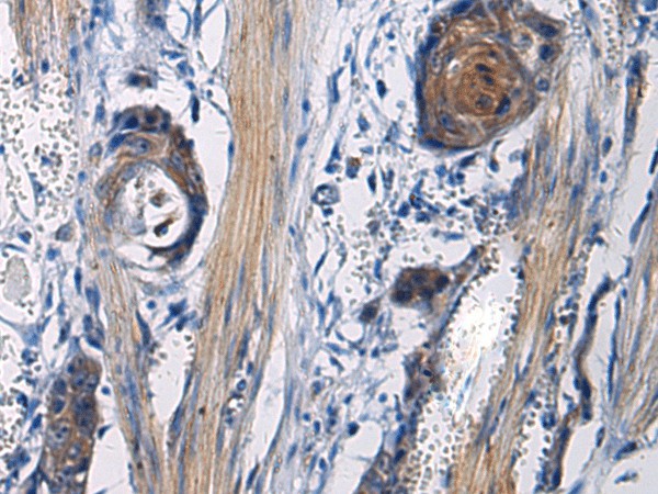ICA1 Polyclonal Antibody (E-AB-53153)