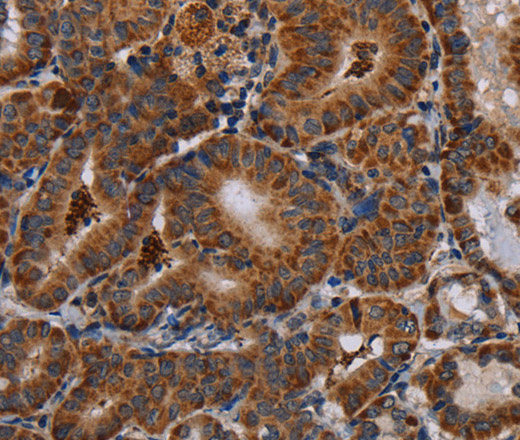 DISC1 Polyclonal Antibody (E-AB-12369)