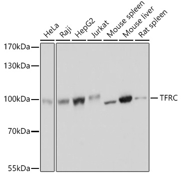 TFRC Polyclonal Antibody (E-AB-61161)