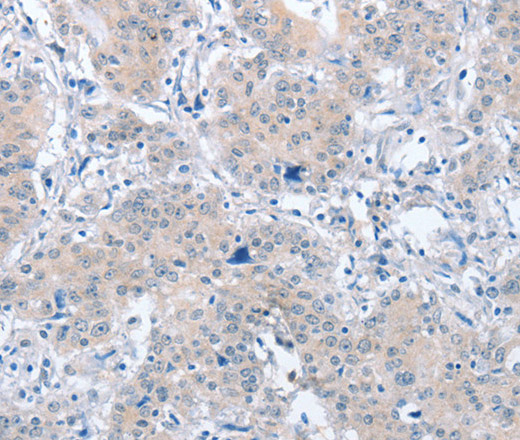 PARD6A Polyclonal Antibody (E-AB-14283)