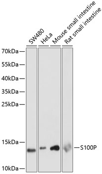 S100P Polyclonal Antibody (E-AB-65108)