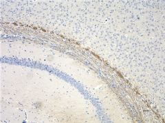 Anti-Neurofilament H & M (NF-H/NF-M), Hypophosphorylated Antibody (Previously Covance catalog# SMI-35R)