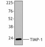 Purified anti-TIMP-1 Antibody (635302)