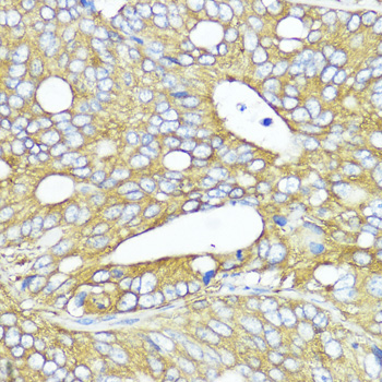 MLKL Polyclonal Antibody (E-AB-67102)
