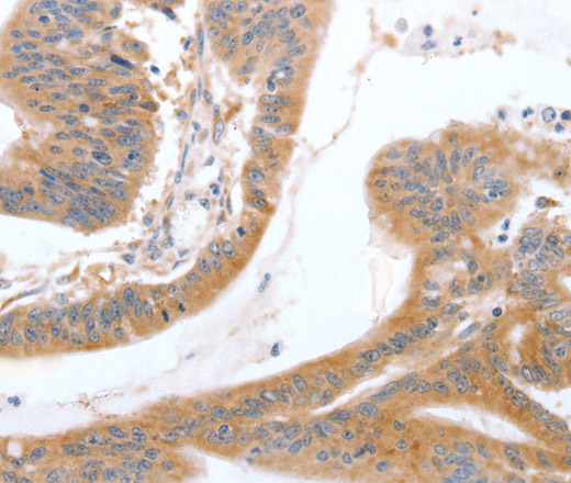 TGFA Polyclonal Antibody (E-AB-10642)