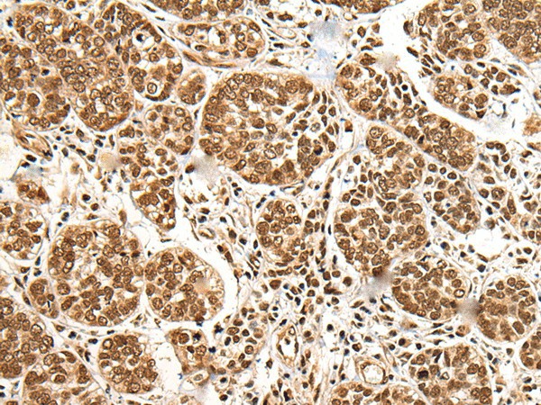 BRSK1 Polyclonal Antibody (E-AB-52484)