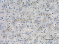 Purified anti-CD243/ABCB4 (MDR-1, MDR3) Antibody (Previously Covance catalog# SIG-38710) (903701)