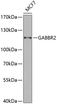 GABBR2 Polyclonal Antibody (E-AB-67776)