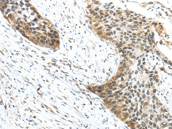 TRIP6 Polyclonal Antibody (E-AB-17156)