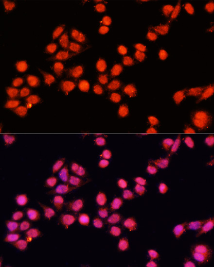 SLC24A5 Polyclonal Antibody (E-AB-66465)