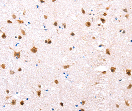 ER alpha Polyclonal Antibody (E-AB-15624)