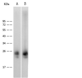 Recombinant IL36B/IL1F8 Monoclonal Antibody (AN300570P)
