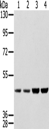 SSB Polyclonal Antibody (E-AB-13694)