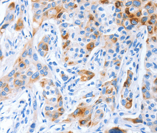 CD133 Polyclonal Antibody (E-AB-16223)