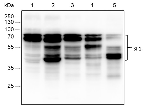 Recombinant SF1 Monoclonal Antibody (AN302071L)