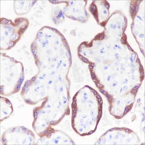 Recombinant hCG beta Monoclonal Antibody (AN301544L)