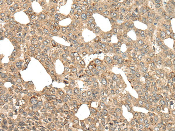 APC Polyclonal Antibody (E-AB-17831)