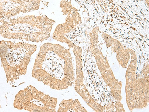 BEX2 Polyclonal Antibody (E-AB-52803)