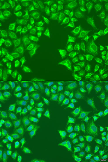 LRP6 Polyclonal Antibody (E-AB-66414)
