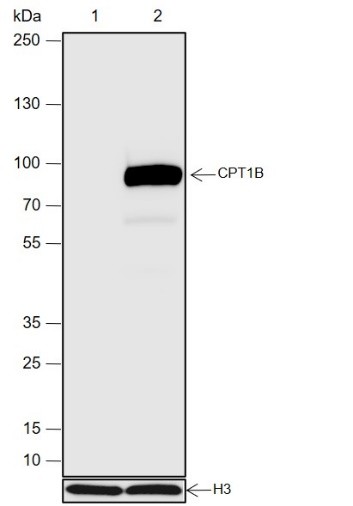 Recombinant CPT1B Monoclonal Antibody (AN301956L)