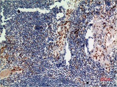 ERK 1 Monoclonal Antibody (E-AB-22247)
