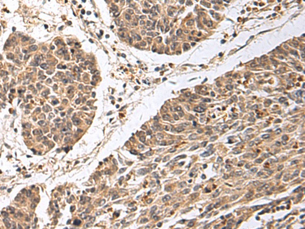 CD24 Polyclonal Antibody (E-AB-53309)