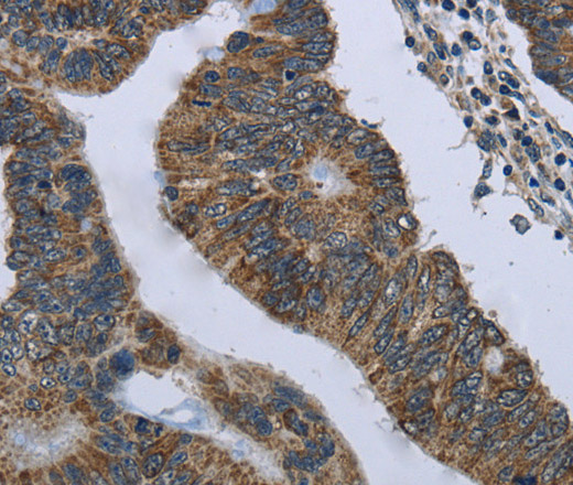CD236 Polyclonal Antibody (E-AB-15080)