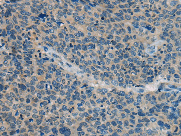 BACE2 Polyclonal Antibody (E-AB-53590)