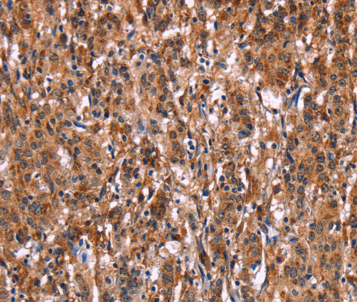 LILRB1 Polyclonal Antibody (E-AB-10412)