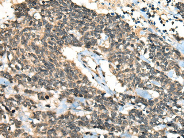 CCNB1IP1 Polyclonal Antibody (E-AB-52525)