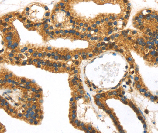 SERPINB8 Polyclonal Antibody (E-AB-15386)