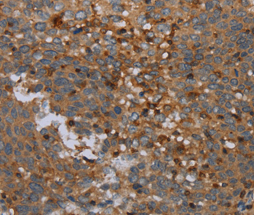OTOR Polyclonal Antibody (E-AB-13475)