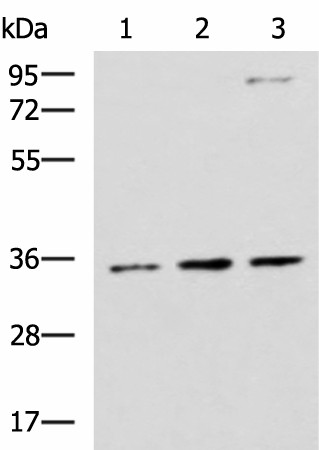 STX5 Polyclonal Antibody (E-AB-52597)