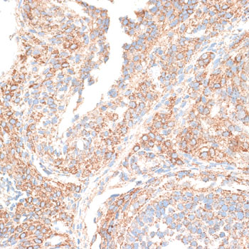 KIF14 Polyclonal Antibody (E-AB-63327)