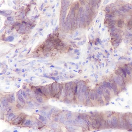 Recombinant hENT1 Monoclonal Antibody (AN301547L)